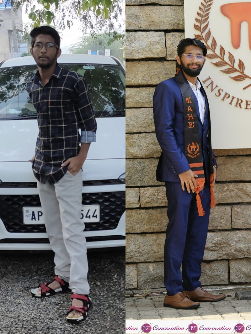 Manoj before and after